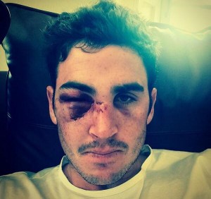 Craig Kieswetter