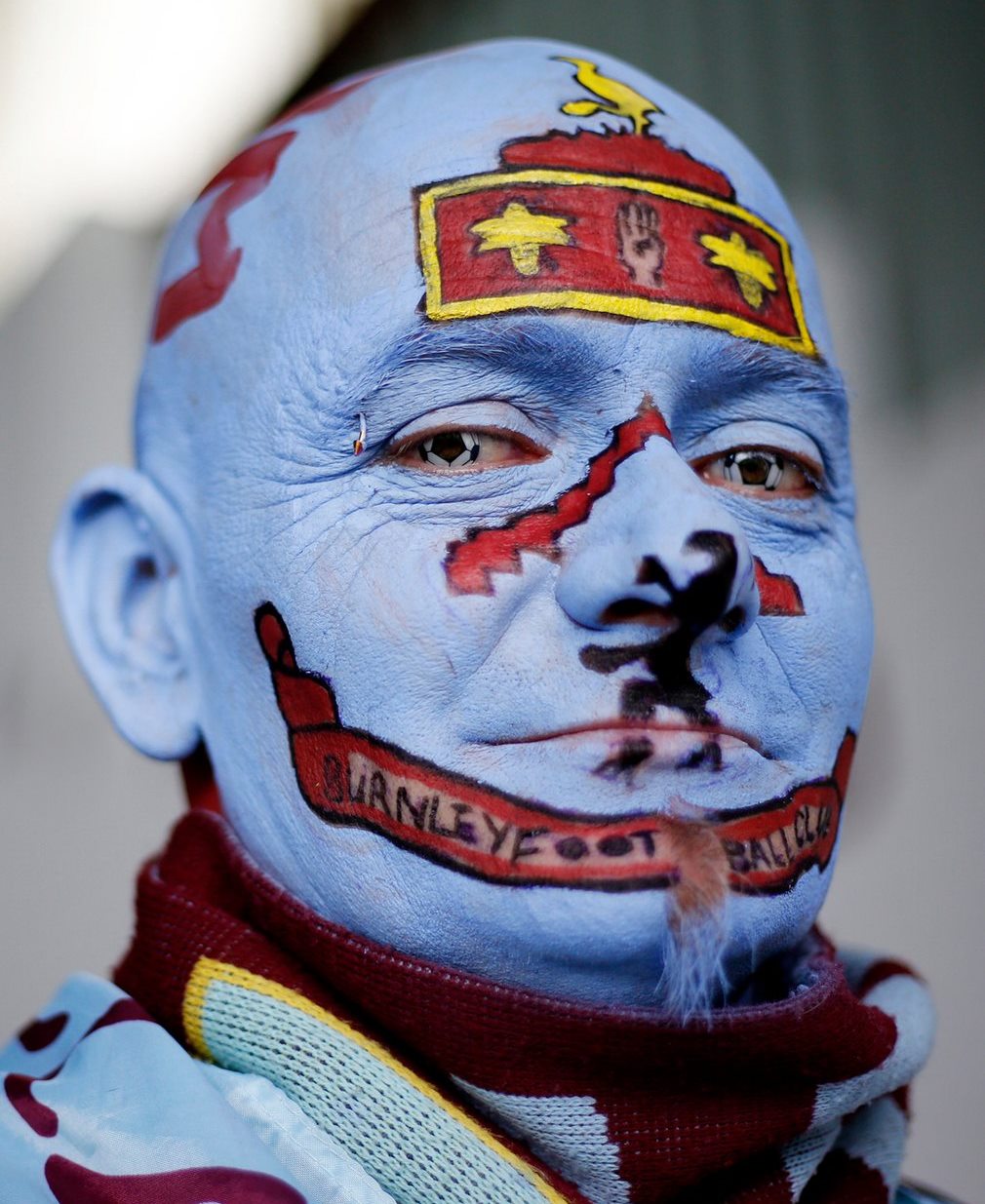 Burnley fan